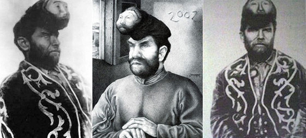 Vào năm 20 tuổi, Pinon trải qua cơn đột quỵ nghiêm trọng khiến chiếc đầu thứ hai tê liệt hoàn toàn và không cử động được như trước. Dù vậy, những cuộc biểu diễn của Pinon với 2 chiếc đầu vẫn khiến khán giả thích thú và tò mò.