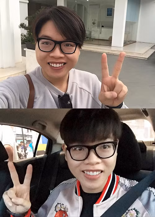 Sau khi giảm cân, Đức Phúc xuất hiện với hình ảnh gầy gò hốc hác do lịch diễn khá dày và việc học tập căng thẳng nên thường xuyên mất ngủ, bỏ bữa. Ảnh: FBNV