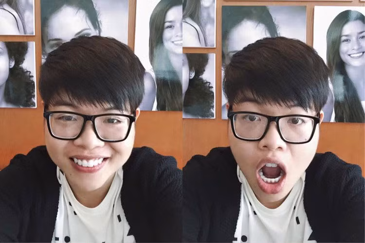 Khi mới đăng quang, “chàng trai đong đưa” bày tỏ không nghĩ đến vấn đề phẫu thuật phẩm mỹ. Tuy nhiên, Đức Phúc muốn nhờ đến sự can thiệp của nha sĩ để có nụ cười đẹp hơn. Ảnh: FBNV