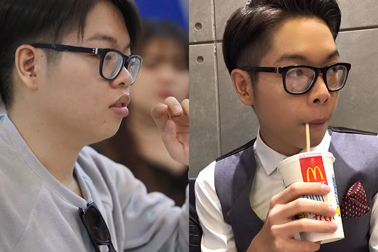 Bị chê ngoại hình thiếu sức sống sau khi giảm cân, Đức Phúc quyết định phẫu thuật thẩm mỹ. Ảnh: FBNV