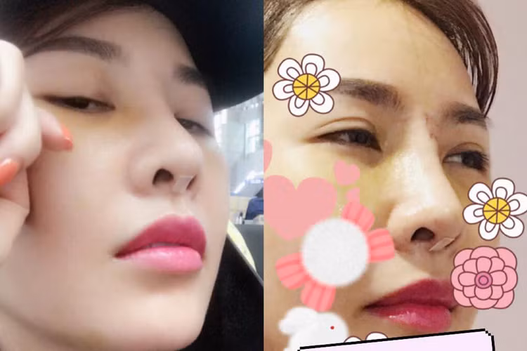 Là sao Việt công khai dao kéo, Quế Vân khoe chiếc mũi sau khi phẫu thuật thẩm mỹ lần 2.