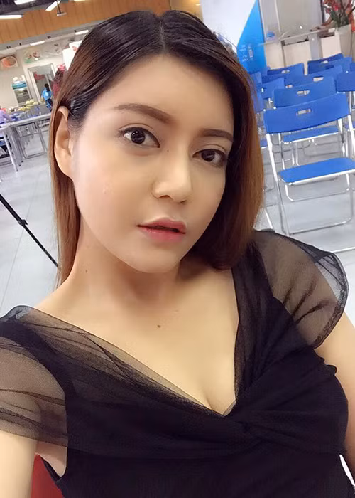 Cũng như quán quân Đức Phúc, Á quân Xuân Nghi không ngại công khai quá trình đại phẫu thuật thẩm mỹ. Cô đã chỉnh sửa lại khuôn mặt và cơ thể. Ảnh: FBNV