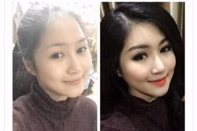 Tháng 3/2014, sau khi clip dao kéo bị rò rỉ, Hương Tràm thừa nhận sửa mũi vì tướng số. Nhờ chiếc mũi thon gọn, gương mặt của nữ ca sĩ trông thanh thoát hơn. Ảnh: FBNV