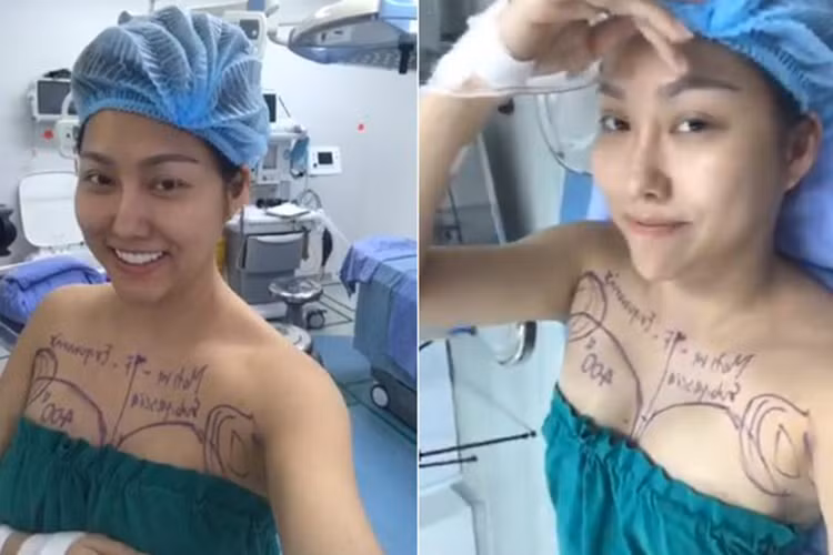 Phi Thanh Vân tiết lộ tổng chi phí cho cuộc phẫu thuật thẩm mỹ lần này là hơn 500 triệu đồng.