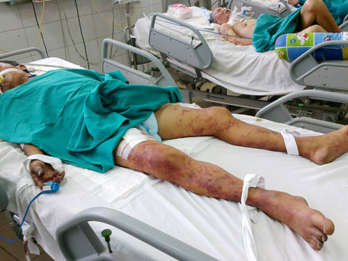 Nhũng hạu quả khủng khiép khi an tiet canh lon-Hinh-3