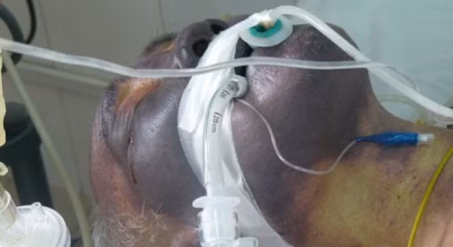 Nhũng hạu quả khủng khiép khi an tiet canh lon-Hinh-2