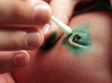 Nhung dieu can biet ve benh nhiem trung mau rat nguy hiem-Hinh-2