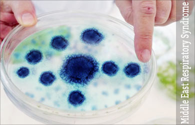 Theo tổ chức Y tế thế giới, một nghiên cứu của các nhà khoa học cho rằng ổ chứa MERS-CoV có thể từ lạc đà. Thực tế, trong số các bệnh nhân được báo cáo nhiễm MERS-CoV, nhiều bệnh nhân có tiền sử tiếp xúc với lạc đà và uống sữa lạc đà tươi.