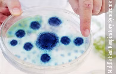 Theo tổ chức Y tế thế giới, một nghiên cứu của các nhà khoa học cho rằng ổ chứa MERS-CoV có thể từ lạc đà. Thực tế, trong số các bệnh nhân được báo cáo nhiễm MERS-CoV, nhiều bệnh nhân có tiền sử tiếp xúc với lạc đà và uống sữa lạc đà tươi.