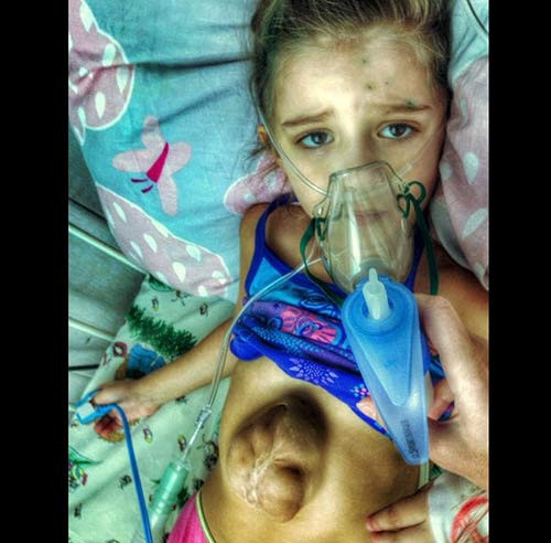 Bà Dari Borum mẹ của cô bé cũng đang cố gắng hết sức để có thể phẫu thuật cho con gái.