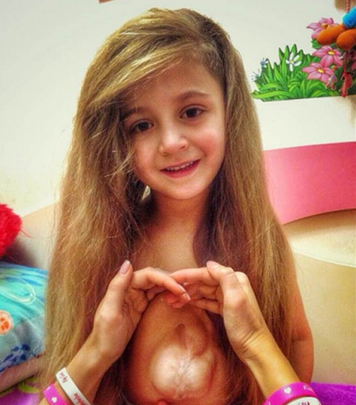 Hội chứng trên khiến trái tim của cô bé nằm bên ngoài lông ngực ngay từ khi mới chào đời.