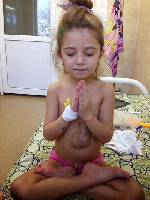 Ca phẫu thuật của Virsaviya dự kiến được thực hiện vào 23/2/2015 vừa qua. Tuy nhiên, nó đã bị hoãn lại vì gia đình em không đủ tiền để trang trải cho các chi phí y tế khi điều trị.