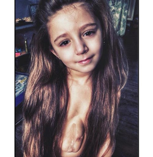 Cha mẹ Virsaviya Bathsheba đã đưa con đi điều trị căn bệnh kỳ lạ trên nhiều lần nhưng đều bị từ chối.