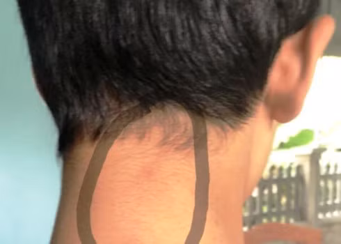 Nhom phu huynh tan cong nam sinh lop 8 THCS Quang Ninh: con do... xu the nao?