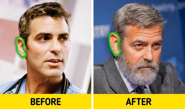  10. Lực hấp dẫn khiến mũi và tai to dần lên theo thời gian: Lý do khiến mũi và tai to ra theo tuổi thực sự là do da bị chùng xuống và do tác động của trọng lực lên đó. Điều này cũng xảy ra với các cơ quan khác của cơ thể, tuy nhiên, 2 cơ quan này là những cơ quan dễ nhìn thấy nhất.