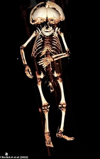 Các nhà khoa học cũng đã nghiên cứu răng cũng như đo xương của đứa trẻ. Kết quả cho thấy em bé này từ 12 - 18 tháng tuổi khi qua đời. Cậu bé có mái tóc đen và thừa cân so với tuổi của mình, cho thấy cậu đã được ăn uống và chăm sóc đầy đủ.