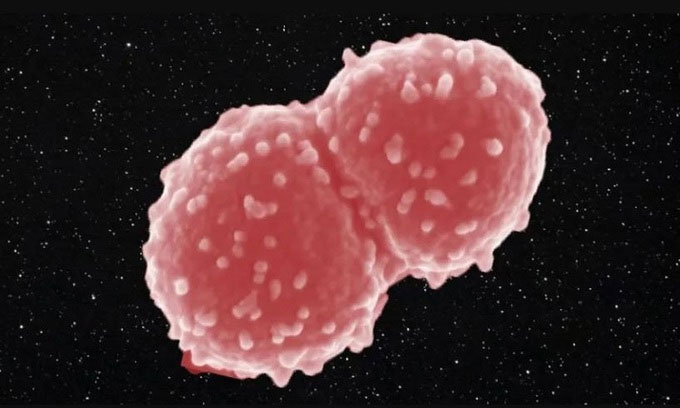  1. Vi khuẩn Deinococcus Radioduran: Nhiều loài sinh vật có thể sống sót ngay cả nếu có xảy ra chiến tranh hạt nhân. Vi khuẩn Deinococcus radiodurans được xem là loài sinh vật duy nhất có khả năng lạ lùng, khôi phục lại bộ gien bị nứt làm hàng nghìn mảnh.