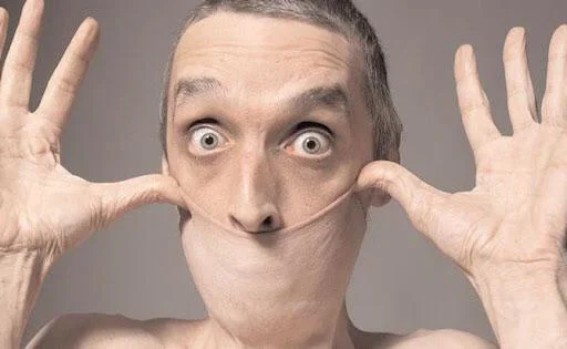 Khả năng này thực tế là hội chứng của căn bệnh hiếm có tên Ehlers Danlos. Anh có thể kéo phần da trên bụng của mình ra đến 15cm.