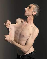  4. Gary Turner : Gary Turner là một nghệ sĩ trình diễn. Anh hiện đang giữ kỷ lục Guiness về khả năng kéo da giãn dài nhất thế giới.