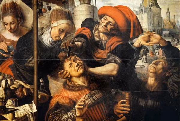 Tại phía nam trung tâm vùng cao nguyên Andes, phẫu thuật trepanning xuất hiện từ năm 200 đến 600. Phương pháp chữa trị này được sử dụng rộng rãi cho đến đầu thế kỷ XVI; ở Trung Quốc, nó đã được áp dụng trong hàng ngàn năm liền.