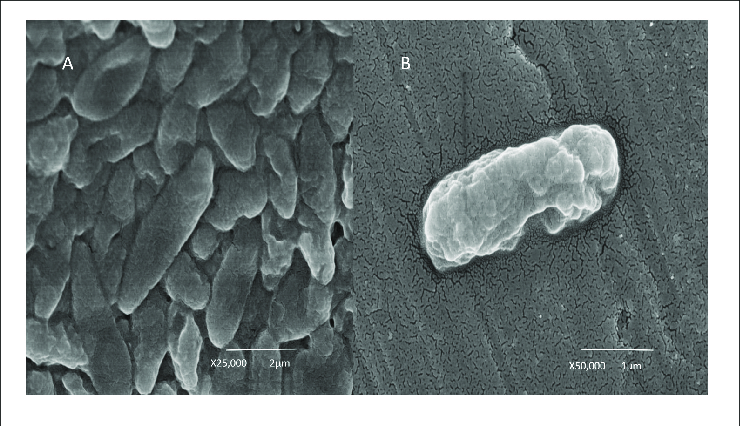 Để giải quyết vấn đề này, vi khuẩn C. metallidurans sử dụng enzyme CupA để vận chuyển đồng ra khỏi tế bào. Nhưng sự hiện diện của vàng gây ra một vấn đề mới. "Khi có mặt các hợp chất của vàng, enzyme CupA bị ức chế, điều này khiến các hợp chất của đồng và vàng vẫn còn trong tế bào vi khuẩn", Nies cho biết.