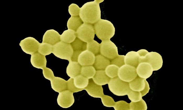 "Nếu một sinh vật quyết định sống sót tại đó, nó phải tìm ra cách để tự bảo vệ mình khỏi những chất độc hại này", Dietrich H. Nies, nhà vi sinh học tại Đại học Martin Luther Halle-Wittenberg (MLU), Đức, cho biết.