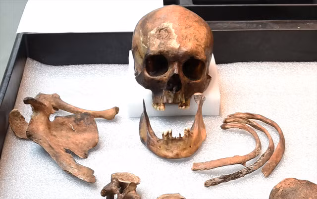 Người ta bắt đầu nghiên cứu hài cốt của John Barber từ năm 1990 khi quan tài của ông được tìm thấy ở một mỏ sỏi ở Griswold, bang Connecticut. Ông bị mất răng cửa hàm trên, điều đó càng chứng minh không hề có khả năng Barber là “ma cà rồng” có thể cắn cổ người khác để hút máu. Ông từng bị gãy xương đòn, viêm khớp và những dấu vết trên xương sườn cho thấy có lẽ Barber đã chết rất đau đớn do căn bệnh lao.