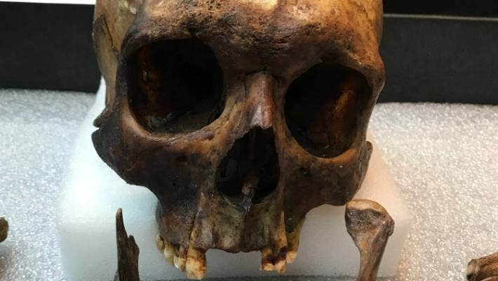 Dịch lao lây lan nhanh chóng và đáng sợ, tuy nhiên người đương thời không biết về căn bệnh này và cho rằng những người chết trở thành ma cà rồng, đội mồ sống dậy, đi hút máu và lây truyền bệnh dịch cho người sống. Người mắc bệnh lao ho ra máu, nhợt nhạt, hốc hác, tím tái và có những ven máu nổi lên quanh miệng - có lẽ vì vậy mà họ bị cho là “ma cà rồng”.