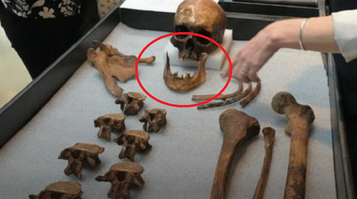 Các vụ việc tương tự đã xuất hiện từ lâu ở châu Âu, nơi có nhiều trường hợp ghi nhận các xác chết bị đào lên, đốt cháy, sắp xếp lại các bộ phận, chặt đầu…