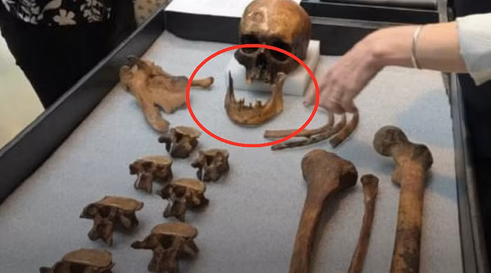 Các vụ việc tương tự đã xuất hiện từ lâu ở châu Âu, nơi có nhiều trường hợp ghi nhận các xác chết bị đào lên, đốt cháy, sắp xếp lại các bộ phận, chặt đầu…