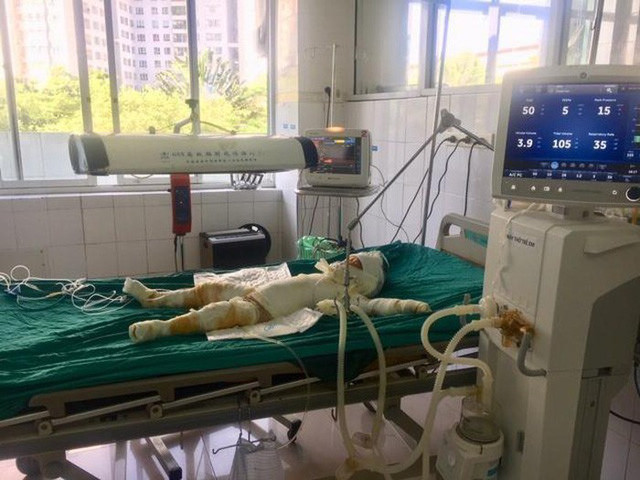 Vu tuoi xang dot 5 nguoi trong nha o Son La: Be 3 tuoi da tu vong-Hinh-3