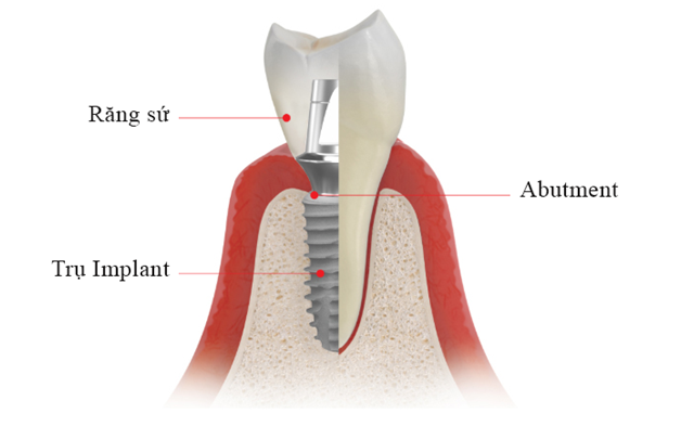 Ban da biet gia trong rang vinh vien la bao nhieu chua?-Hinh-4