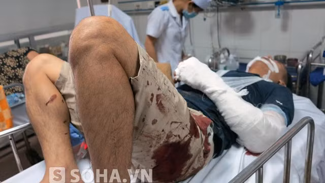 Tài xế Nguyễn Bá Thành bất tỉnh và bị đa chấn thương, gãy tay và chân.