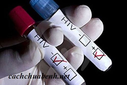 Sau khi bệnh nhân đã được sử dụng thuốc kháng virus, cần tiếp tục xét nghiệm HIV lại sau 10 tuần kể từ thời điểm bị phơi nhiễm hoặc có yếu tố nguy cơ. Nếu kết quả xét nghiệm là âm tính, có thể yên tâm rằng không bị lây nhiễm HIV trong tình huống đó.