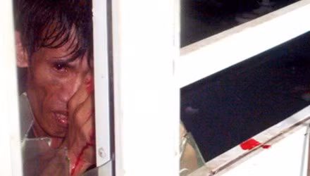 Bị người nhiễm HIV bôi máu vào người cũng là một tình huống có thể gây phơi nhiễm.