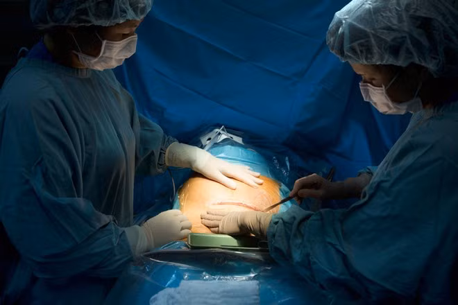 Sau ca mổ, các bác sĩ, hộ sinh này phải điều trị phơi nhiễm HIV.