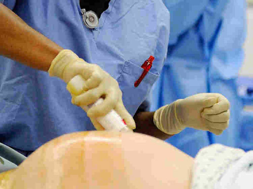 Ngày 26/9/2011, ở Quảng Trị có 5 bác sĩ hộ sinh phơi nhiễm HIV khi mổ đẻ ở. Do sơ suất, 5 nhân viên y tế ở khoa Sản, Bệnh viện Đa khoa tỉnh Quảng Trị đã bị sây sát, kim tiêm đâm vào tay, máu của người bệnh có HIV bắn vào mắt...