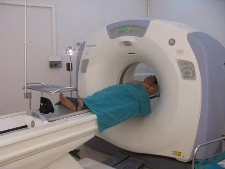 Ngay sau sinh thiết, bệnh nhân được chụp lại phim cắt lớp vi tính ngực để đánh giá các tai biến chảy máu nhu mô phổi, chảy máu màng phổi, tràn khí màng phổi.