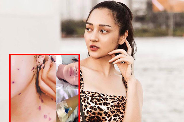 Tháng 4/2018, Bảo Anh hủy show sau khi nhập viện do làm việc quá sức trong nhiều ngày. Cô bị sốt cao, đau họng sau đó bị phát bệnh thủy đậu. Ảnh: Danviet