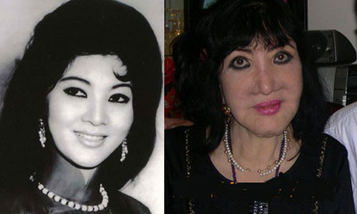 Tu Duc Phuc den bi kich sao Viet dao keo: Cang sua cang tham-Hinh-3