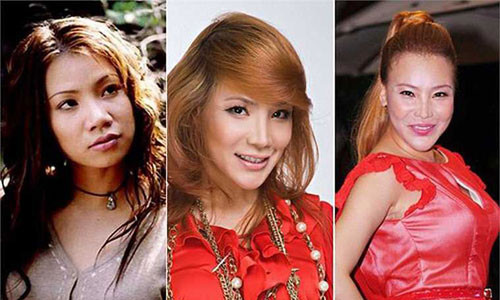 Tu Duc Phuc den bi kich sao Viet dao keo: Cang sua cang tham-Hinh-4