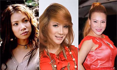 Tu Duc Phuc den bi kich sao Viet dao keo: Cang sua cang tham-Hinh-4