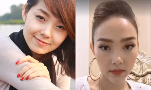 Tu Duc Phuc den bi kich sao Viet dao keo: Cang sua cang tham-Hinh-5