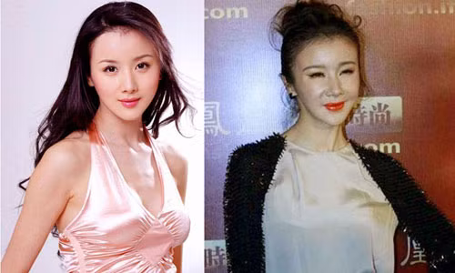 Tu Duc Phuc den bi kich sao Viet dao keo: Cang sua cang tham-Hinh-6