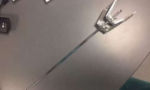 Thanh sắt xuyên thủng sọ, bé trai 10 tuổi sống sót kỳ diệu - Hình 3 Thanh sat xuyen thung so, be trai 10 tuoi song sot ky dieu-Hinh-3