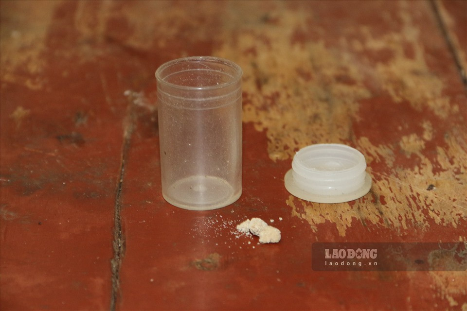 Ông Đinh Văn Đân (người dân khu tái định cư Mai Sơn) còn cho PV thấy những viên sỏi thận ông bảo quản cẩn thận trong hộp nhỏ từ khi uống nước giếng khoan.