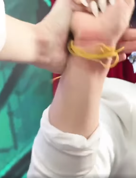 Phần tay của người bị "trừng phạt" đã sưng đỏ cả lên.