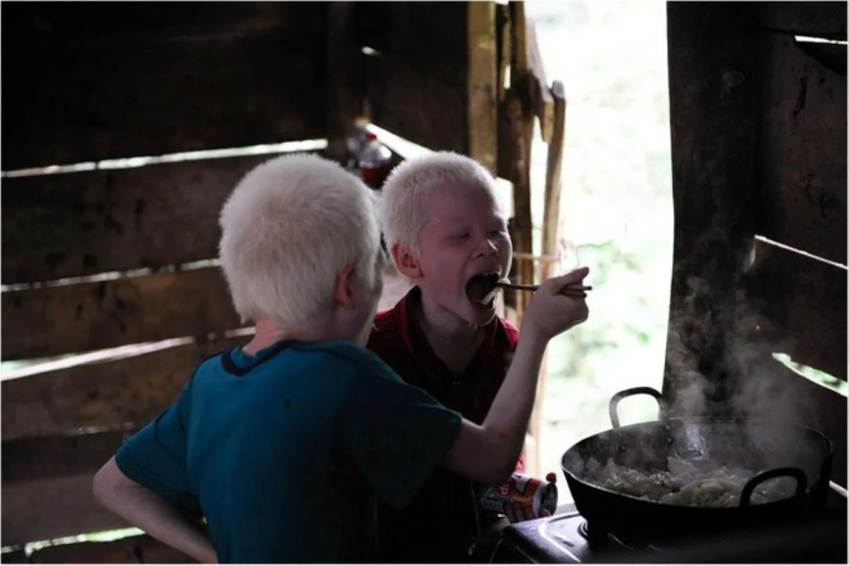 Cả 2 đã trở thành động lực cho những số phận tương tự có thêm niềm tin, niềm hy vọng vào cuộc sống. (Ảnh: FBNV)