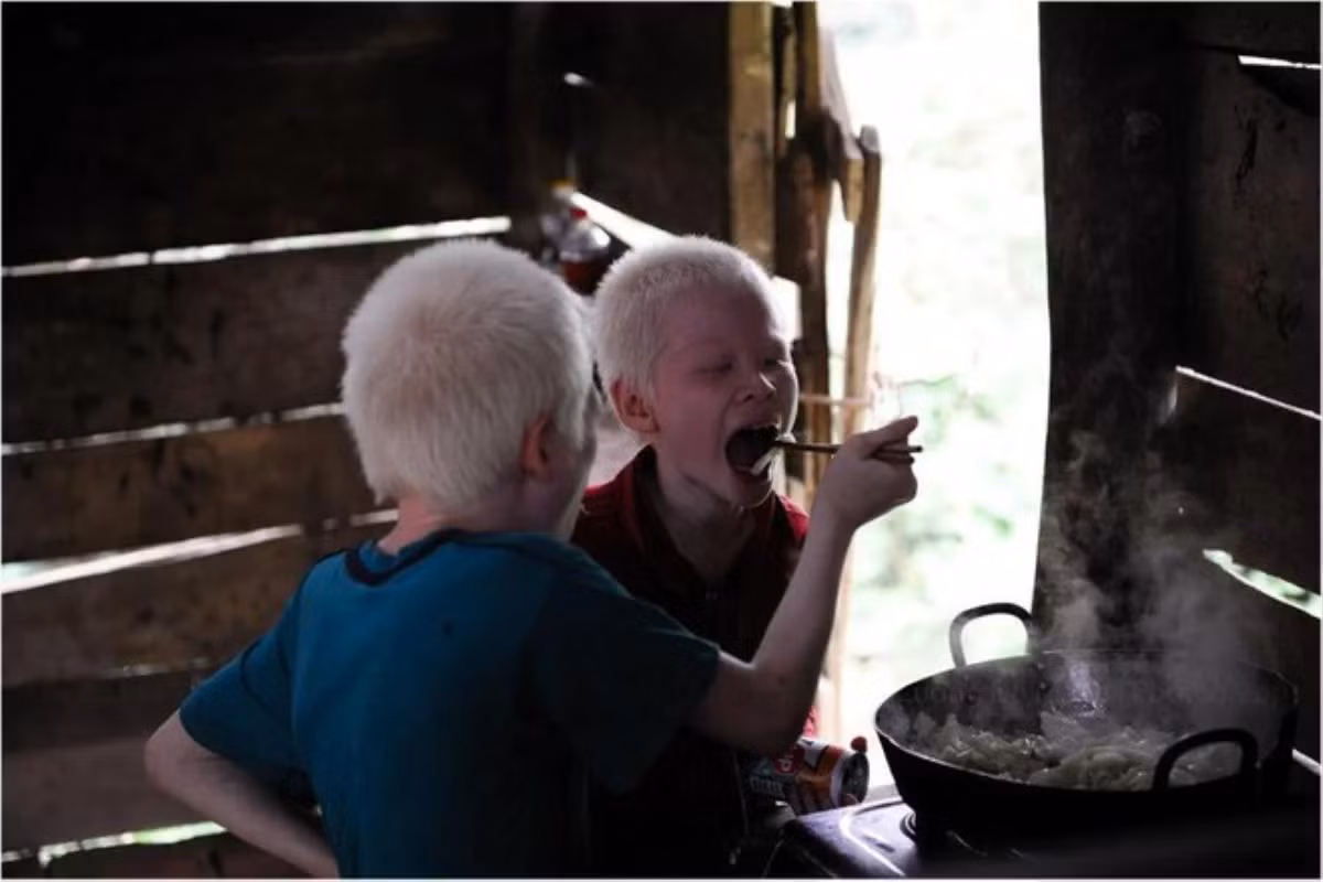 Cả 2 đã trở thành động lực cho những số phận tương tự có thêm niềm tin, niềm hy vọng vào cuộc sống. (Ảnh: FBNV)