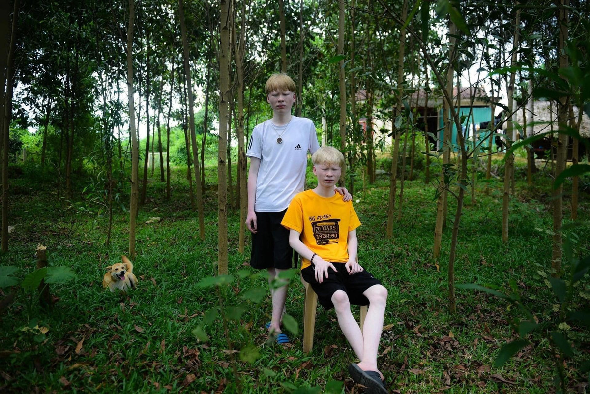 Hai anh em mắc bệnh bạch tạng bẩm sinh. Thuở nhỏ, cũng vì ngoại hình khác biệt nên cả 2 thường bị trêu chọc, anh em Huy - Hùng vì thế mà sống khép kín hơn với người ngoài, trở thành những người bạn thân thiết của nhau.